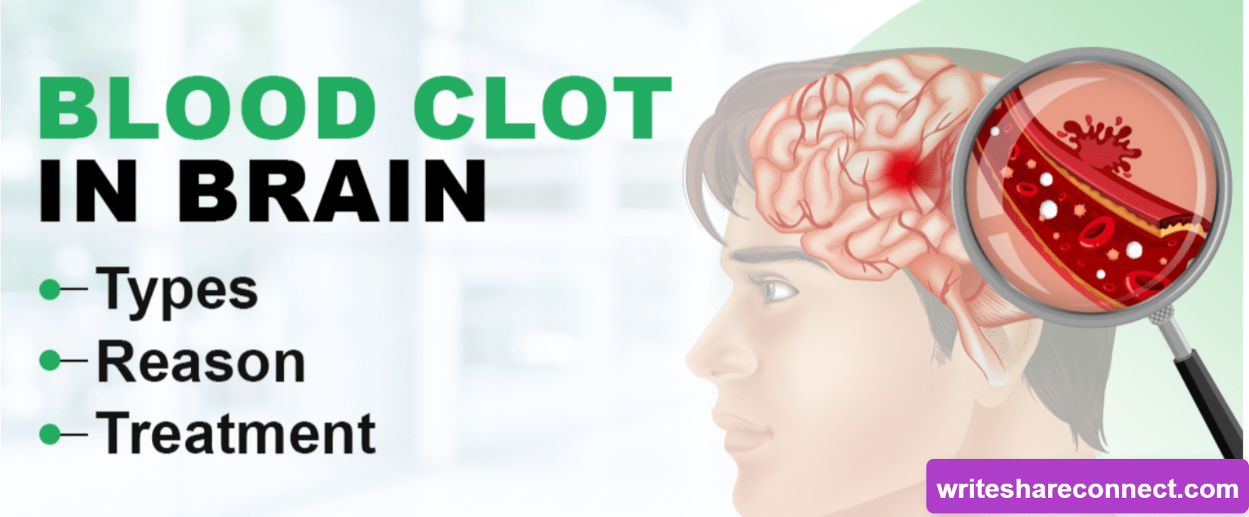 What Leads to Blood Clots in the Brain? Reasons, Symptoms, and Treatment Options